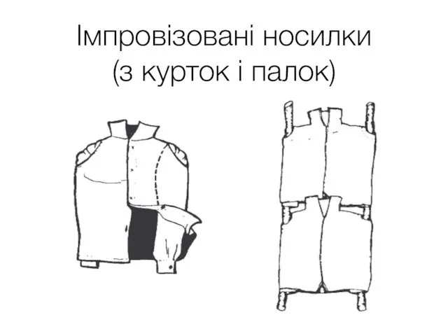 Імпровізовані носилки (з курток і палок)