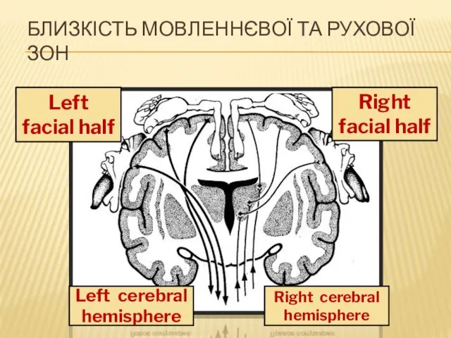 Left facial half Right facial half Left cerebral hemisphere Right