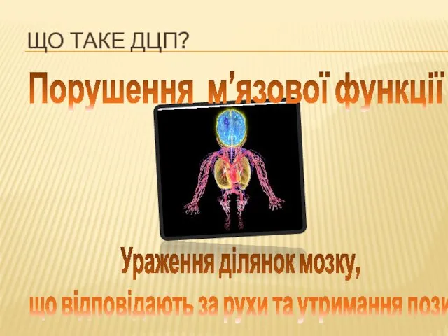 ЩО ТАКЕ ДЦП? Порушення м’язової функції Ураження ділянок мозку, що відповідають за рухи та утримання пози