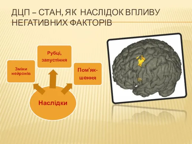 ДЦП – СТАН, ЯК НАСЛІДОК ВПЛИВУ НЕГАТИВНИХ ФАКТОРІВ