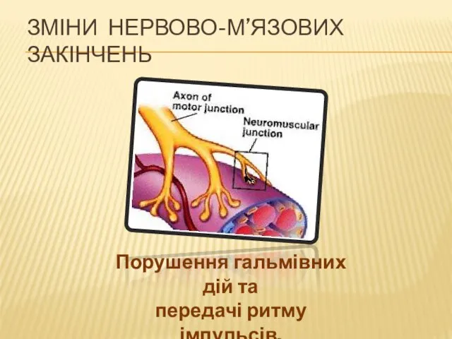 ЗМІНИ НЕРВОВО-М’ЯЗОВИХ ЗАКІНЧЕНЬ Порушення гальмівних дій та передачі ритму імпульсів, що адресовані м’язам