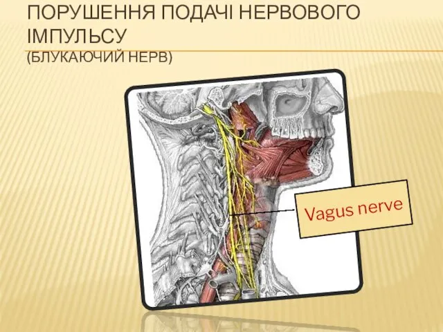 Vagus nerve ПОРУШЕННЯ ПОДАЧІ НЕРВОВОГО ІМПУЛЬСУ (БЛУКАЮЧИЙ НЕРВ)