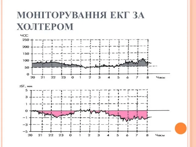 МОНІТОРУВАННЯ ЕКГ ЗА ХОЛТЕРОМ