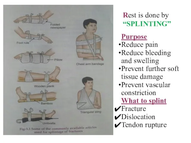 Rest is done by “SPLINTING” Purpose Reduce pain Reduce bleeding