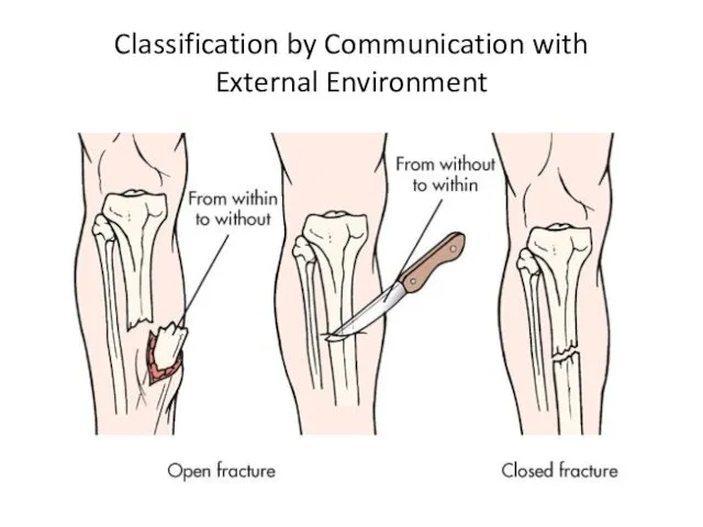 Classification by Communication with External Environment