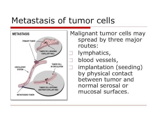 Metastasis of tumor cells Malignant tumor cells may spread by