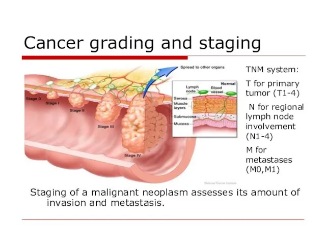Cancer grading and staging Staging of a malignant neoplasm assesses