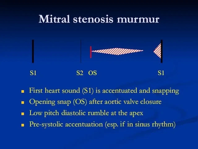 Mitral stenosis murmur First heart sound (S1) is accentuated and snapping Opening snap