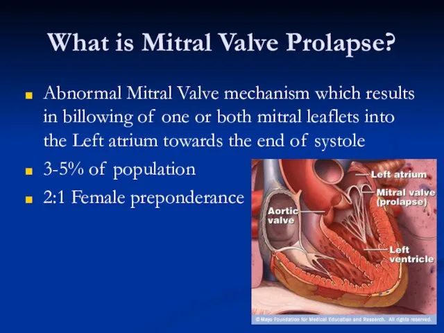 What is Mitral Valve Prolapse? Abnormal Mitral Valve mechanism which results in billowing