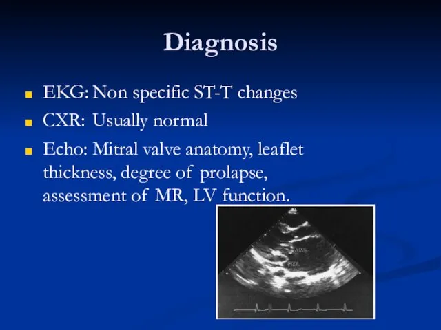 Diagnosis EKG: Non specific ST-T changes CXR: Usually normal Echo: Mitral valve anatomy,