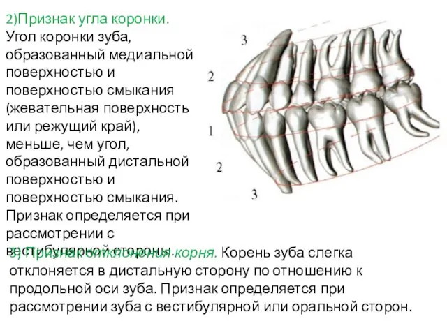 2)Признак угла коронки. Угол коронки зуба, образованный медиальной поверхностью и поверхностью смыкания (жевательная