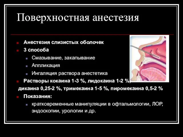 Поверхностная анестезия Анестезия слизистых оболочек 3 способа Смазывание, закапывание Аппликация