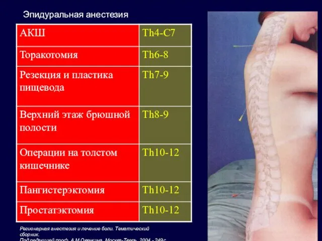 Регионарная анестезия и лечение боли. Тематический сборник. Под редакцией проф.