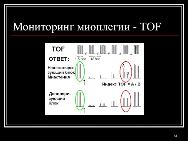 Мониторинг миоплегии - TOF