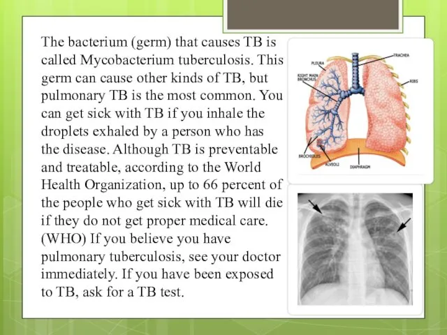 The bacterium (germ) that causes TB is called Mycobacterium tuberculosis.