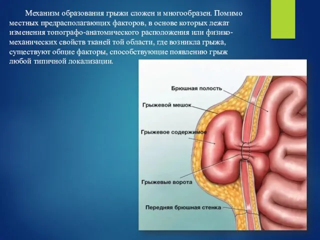 Механизм образования грыжи сложен и многообразен. Помимо местных предрасполагающих факторов,