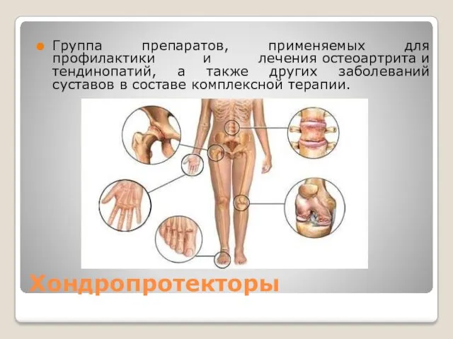 Хондропротекторы Группа препаратов, применяемых для профилактики и лечения остеоартрита и