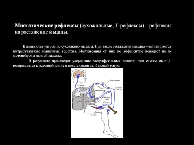Миотатические рефлексы (сухожильные, Т-рефлексы) – рефлексы на растяжение мышцы. Вызываются ударом по сухожилию