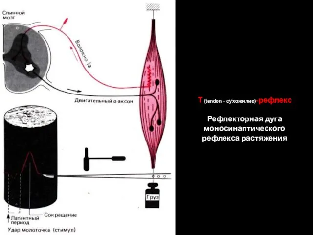 Т (tendon – сухожилие)-рефлекс Рефлекторная дуга моносинаптического рефлекса растяжения