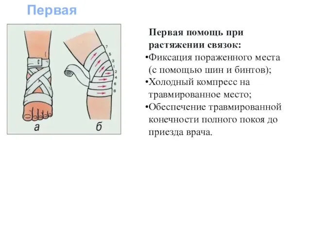 Первая помощь Первая помощь при растяжении связок: Фиксация пораженного места