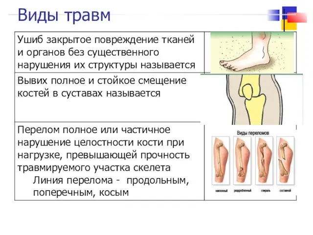 Виды травм