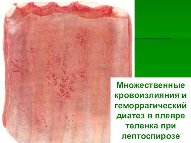 Множественные кровоизлияния и геморрагический диатез в плевре теленка при лептоспирозе