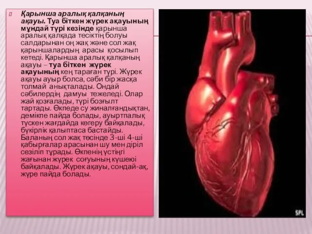 Қарынша аралық қалқаның ақауы. Туа біткен жүрек ақауының мұндай түрі