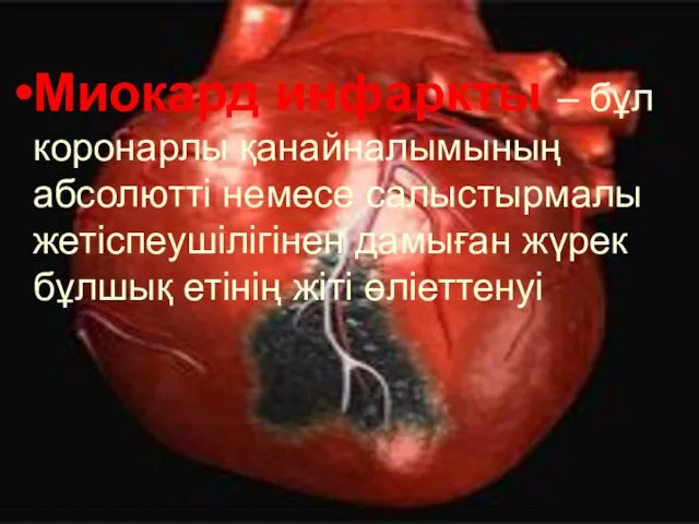 Миокард инфаркты – бұл коронарлы қанайналымының абсолютті немесе салыстырмалы жетіспеушілігінен дамыған жүрек бұлшық етінің жіті өліеттенуі