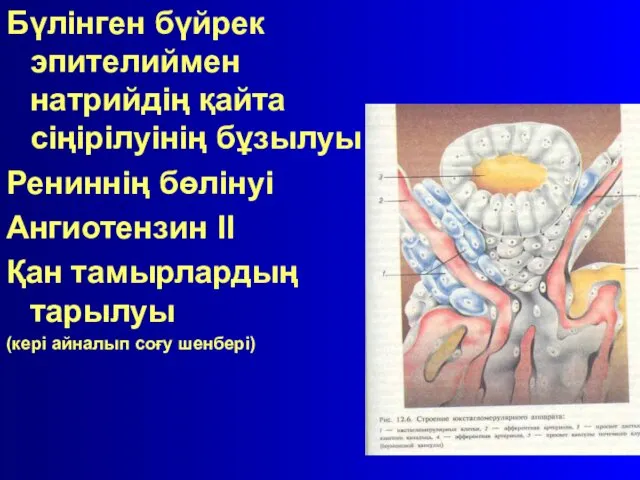 Бүлінген бүйрек эпителиймен натрийдің қайта сіңірілуінің бұзылуы Рениннің бөлінуі Ангиотензин