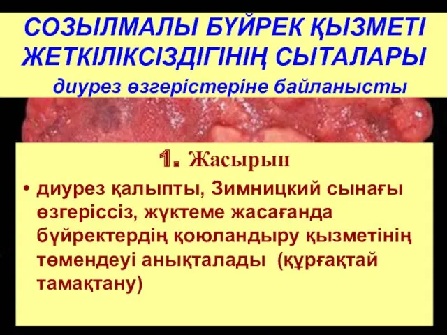 СОЗЫЛМАЛЫ БҮЙРЕК ҚЫЗМЕТІ ЖЕТКІЛІКСІЗДІГІНІҢ СЫТАЛАРЫ диурез өзгерістеріне байланысты 1. Жасырын