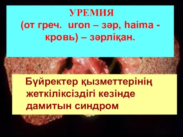 УРЕМИЯ (от греч. uron – зәр, haima - кровь) –