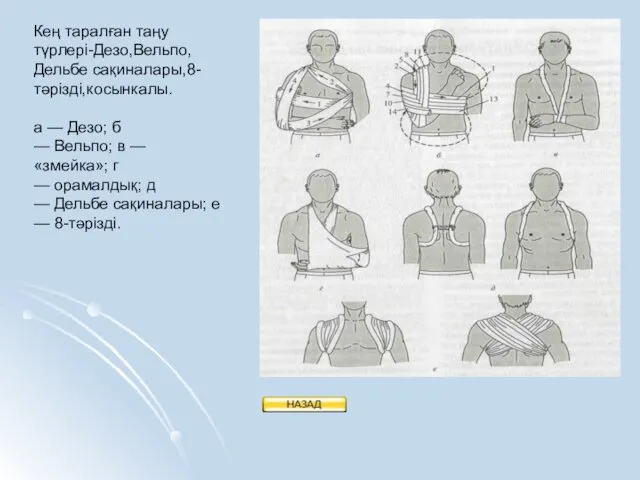 Кең таралған таңу түрлері-Дезо,Вельпо, Дельбе сақиналары,8- тәрізді,косынкалы. а — Дезо;