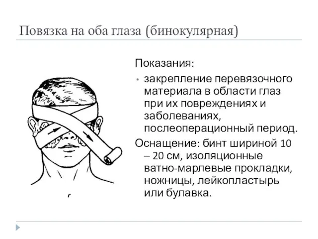 Повязка на оба глаза (бинокулярная) Показания: закрепление перевязочного материала в