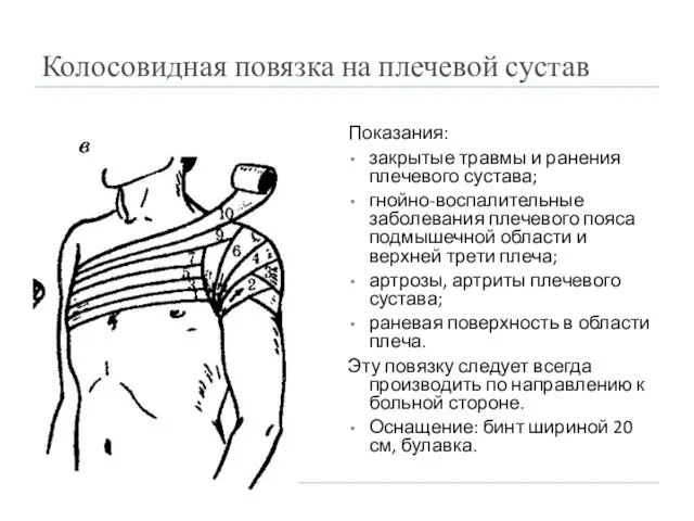 Колосовидная повязка на плечевой сустав Показания: закрытые травмы и ранения
