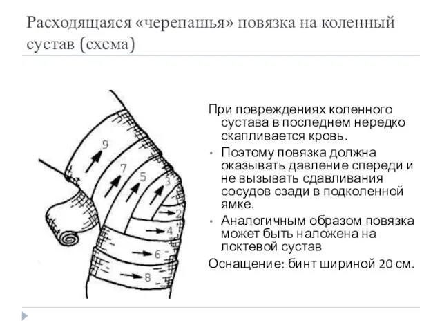 Расходящаяся «черепашья» повязка на коленный сустав (схема) При повреждениях коленного