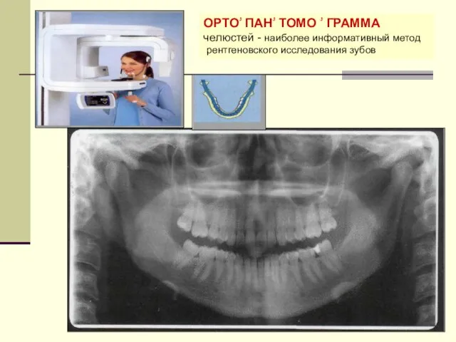 ОРТОۥ ПАНۥ ТОМО ۥ ГРАММА челюстей - наиболее информативный метод рентгеновского исследования зубов