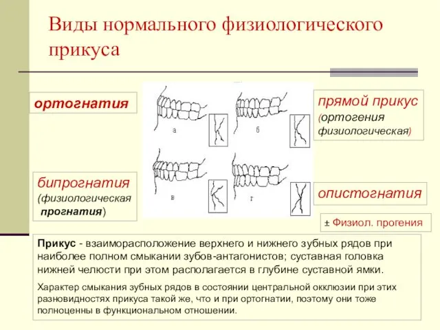 ортогнатия Виды нормального физиологического прикуса бипрогнатия (физиологическая прогнатия) опистогнатия прямой