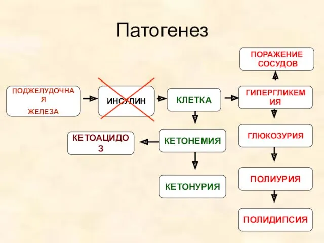 ПОДЖЕЛУДОЧНАЯ ЖЕЛЕЗА ИНСУЛИН КЕТОАЦИДОЗ КЛЕТКА КЕТОНЕМИЯ КЕТОНУРИЯ ГИПЕРГЛИКЕМИЯ ГЛЮКОЗУРИЯ ПОЛИУРИЯ ПОЛИДИПСИЯ Патогенез ПОРАЖЕНИЕ СОСУДОВ