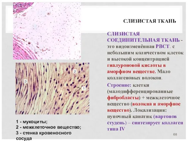 СЛИЗИСТАЯ ТКАНЬ СЛИЗИСТАЯ СОЕДИНИТЕЛЬНАЯ ТКАНЬ - это видоизменённая РВСТ. с