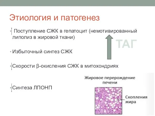 Этиология и патогенез Поступление СЖК в гепатоцит (немотивированный липолиз в