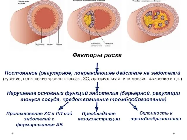 Факторы риска Постоянное (регулярное) повреждающее действие на эндотелий (курение, повышение