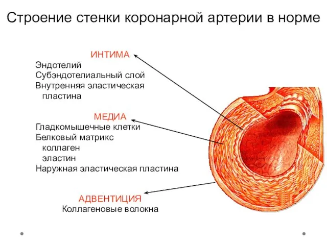 Строение стенки коронарной артерии в норме ИНТИМА Эндотелий Субэндотелиальный слой