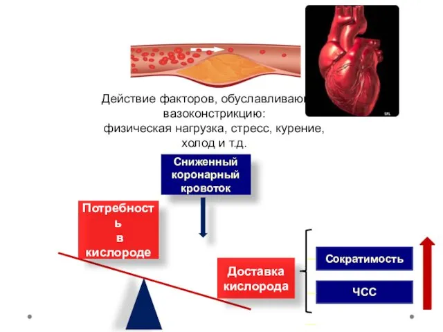 Доставка кислорода Потребность в кислороде Сниженный коронарный кровоток Действие факторов,