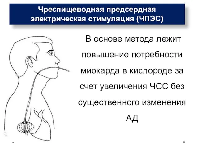 Чреспищеводная предсердная электрическая стимуляция (ЧПЭС) В основе метода лежит повышение