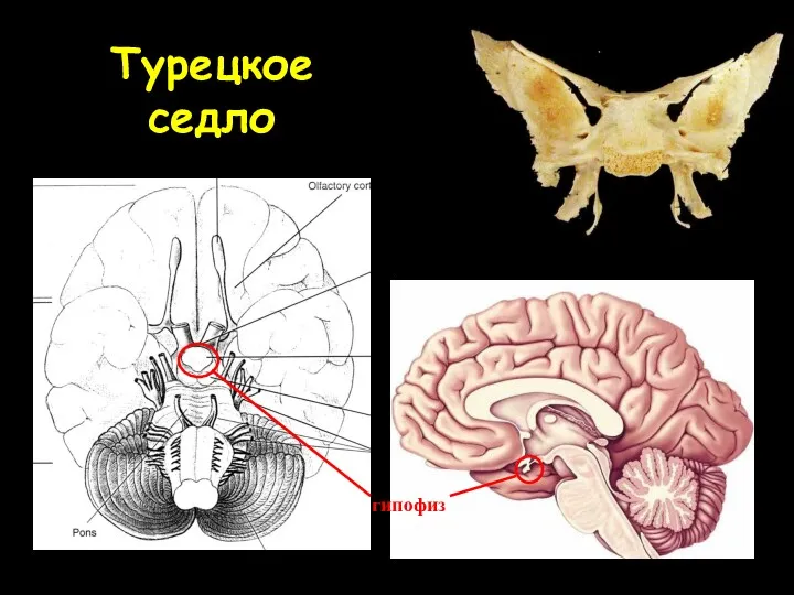 Турецкое седло гипофиз