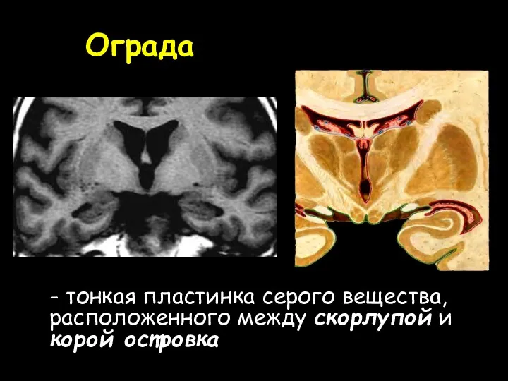 Ограда - тонкая пластинка серого вещества, расположенного между скорлупой и корой островка