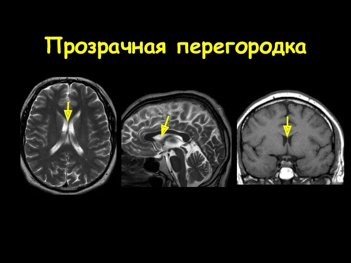 Прозрачная перегородка