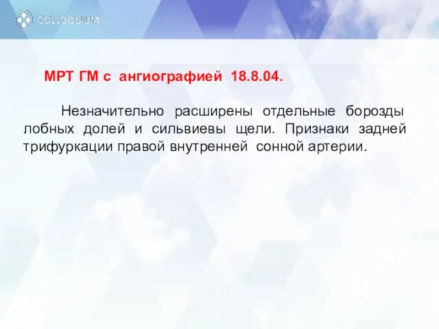 МРТ ГМ с ангиографией 18.8.04. Незначительно расширены отдельные борозды лобных