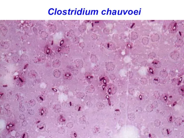 Clostridium chauvoei
