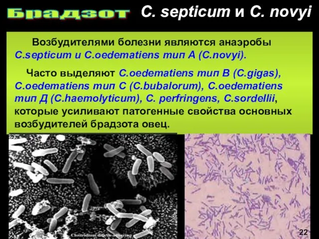 C. septicum и С. novyi Брадзот 24 Возбудителями болезни являются